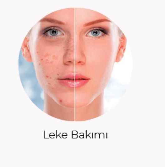 Leke Bakımı