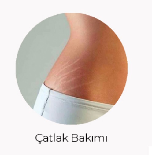 Çatlak bakımı